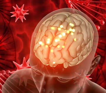 Семейная гиперхолестеринемия оказалась фактором риска поражения сосудов мозга