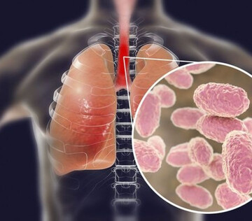 В ряде регионов фиксируют дефицит вакцины от коклюша