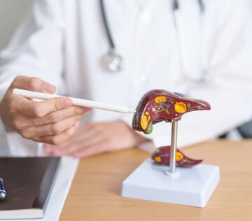 Новгородские специалисты доказали важность мониторинга вен печени при хронических гепатитах