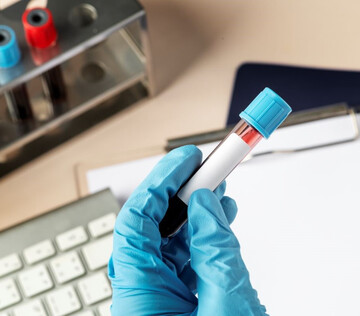 Новый генетический тест точно определит риск развития ожирения у ребенка