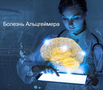 ИИ поможет объединить данные медицинских учреждений для ранней диагностики Альцгеймера
