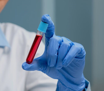 Неизвестную ранее группу крови обнаружили в Индии