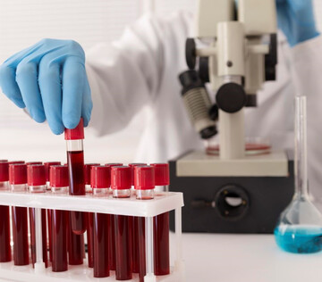 Новый экспресс-метод диагностирует сепсис за несколько часов